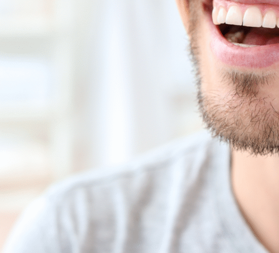 ابتسامة هوليود