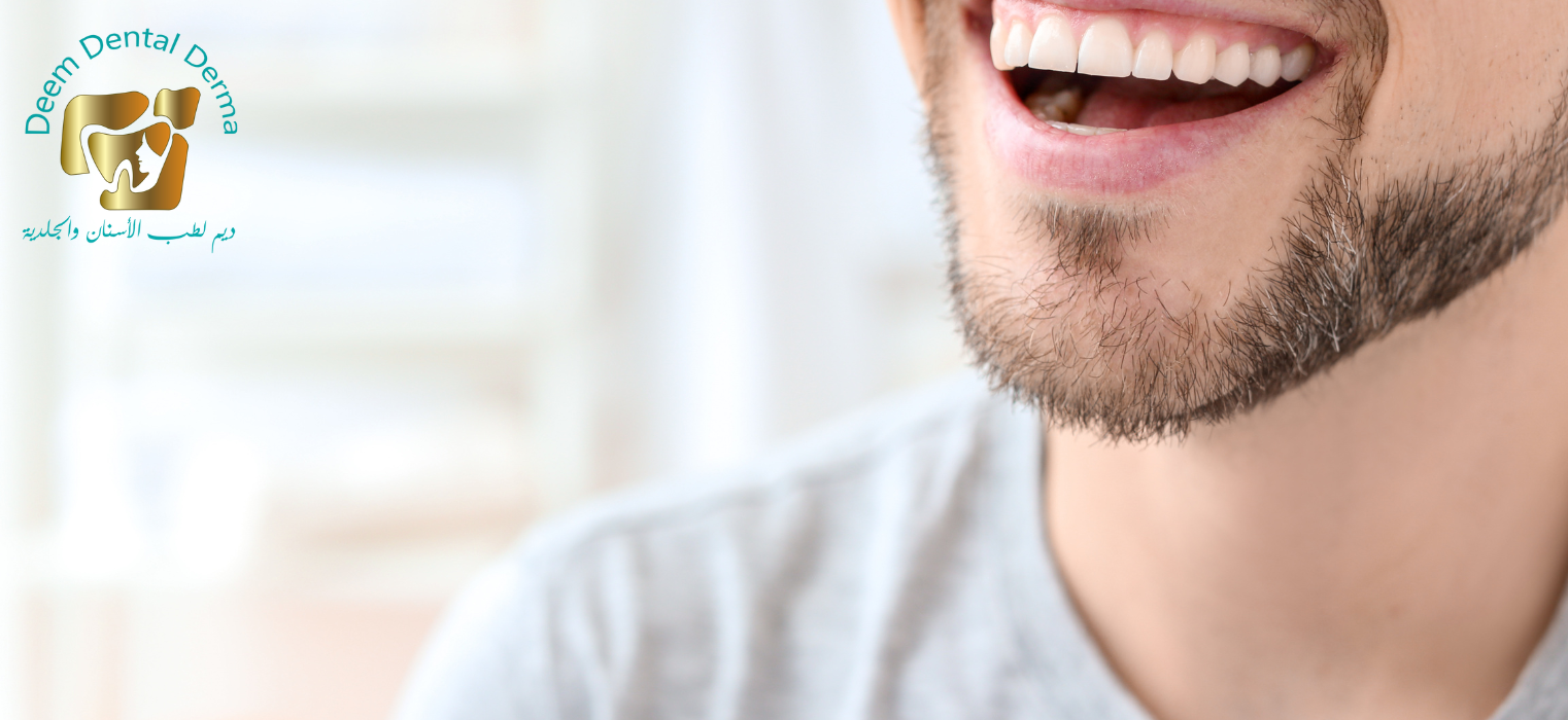 ابتسامة هوليود