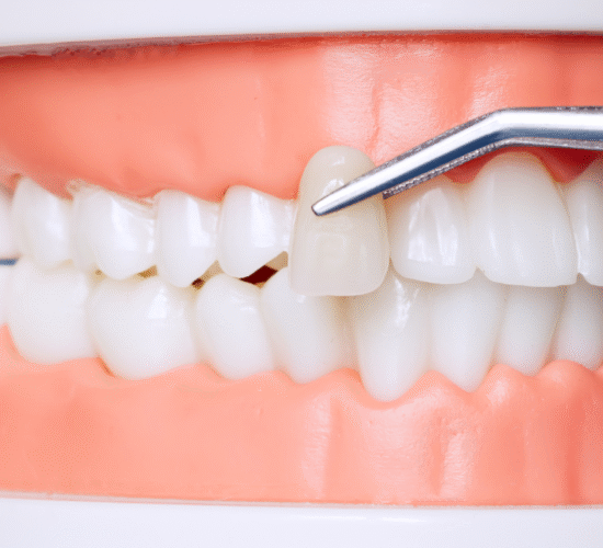 تركيبات وتلبيسات تجميلية